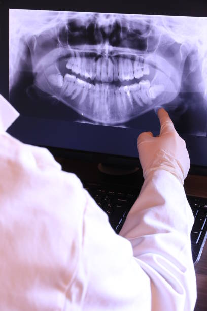 Best Emergency Dental Care for Broken or Chipped Teeth in West Mayfield, PA