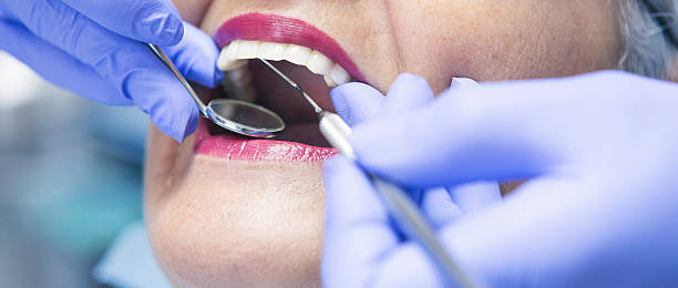 Best Emergency Wisdom Teeth Removal in West Mayfield, PA